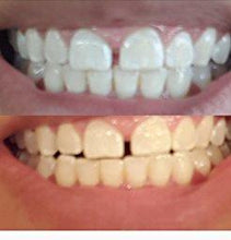 Pack of 3 Activated Charcoal Whitening Powder